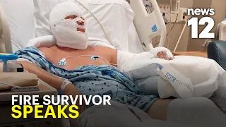 Burn victim speaks after nearly dying in NY boat fire