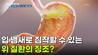 [건강 아지트] 입 냄새로 짐작할 수 있는 위 질환의 징조?! [생방송 굿모닝 대한민국] | KBS 260930 방송