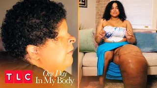 Living Beyond Rare Diagnoses | One Day in My Body | TLC