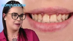 Szewc bez butów ? pracuje w branży beauty, a wstydzi się swojego uśmiechu ? | Bez kompleksów