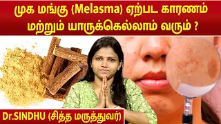 முக மங்கு (Melasma) ஏற்பட காரணம் மற்றும் யாருக்கெல்லாம் வரும் ? | Dr.Sindhu |