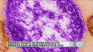 Second inmate at Doña Ana County Detention Center test positive for measles