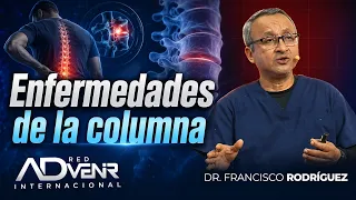Francisco Rodriguez: Spine Disorders