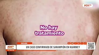 02 Áncash: One confirmed case of measles in Huarmey