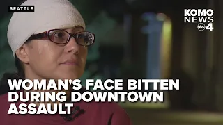 Attacker bites chunk out of woman’s face in downtown Seattle