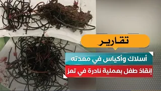 Wires and bags in his stomach.. Child saved in rare surgery in Taiz