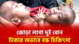 জোড়া লাগা যমজ দুই বোন, টাকার অভাবে বন্ধ চিকিৎসা | Conjoined Twins | Independent TV