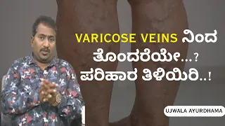 Varicose Veins... ನಿಂತು ಕೆಲಸ ಮಾಡುವವರಿಗೆ ಯಾಕೆ ಹೆಚ್ಚು ಕಾಡುತ್ತದೆ..? | UJWALA AYURDHAMA