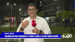 TVE NEWS 09/03/2026 EXPLAINING SHINGLES