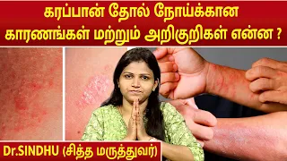 கரப்பான் தோல் நோய்க்கான காரணங்கள் மற்றும் அறிகுறிகள் என்ன ? | ECZEMA Symptoms | Dr.Sindhu |