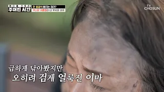 땀💦과 함께 흘러내리는 흑채🙀 여름이 두려워진 이유 TV CHOSUN 260711 방송 | [메디컬 스토리 주어진 시간] 21회 | TV조선