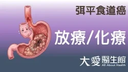 【大愛醫生館】 弭平食道癌 20261009