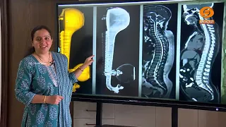 SCIENCE MAGAZINE | ವಿಜ್ಞಾನ ವಿಸ್ಮಯ | Vijnana Vismaya | 02.10.2026 | 6.30pm | DD Chandana