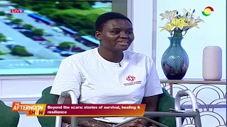 Matilda Oduro, a Burn Survivor, Shares Story