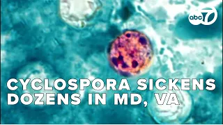Contaminated Food Suspected as Cyclospora Outbreak Sickens Dozens in MD, VA