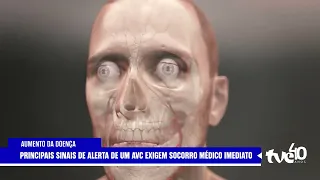 KEY WARNING SIGNS OF A STROKE REQUIRE IMMEDIATE MEDICAL ATTENTION | TVE NEWS 07/29/2026
