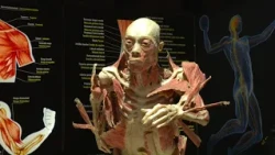 ‘Bodies’ exhibit featuring preserved human specimens opens in Sacramento