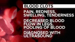 What to know about blood clots as Philadelphia Eagles' Jalen Hurts sidelined