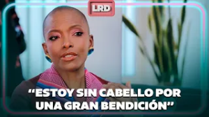 Por qué la modelo Belky Arizala es calva: reveló la verdadera razón - La Red | Caracol TV