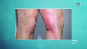 نسولو الطبيب : الأربعاء 25 فبراير 2026