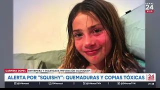 "Squishy" Alert: Burns and Toxic Knockoffs