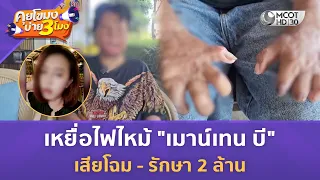 เหยื่อไฟไหม้ "เมาน์เทน บี" เสียโฉม - รักษา 2 ล้าน (21 ก.ค. 69) | คุยโขมงบ่าย 3 โมง