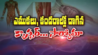 ఎముకలు, కండరాల్లో దాగిన క్యాన్సర్.. సార్కోమా | Cancer Hidden in Bones and Muscles... Sarcoma | Sukhi