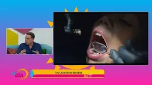 Incrustaciones Dentales