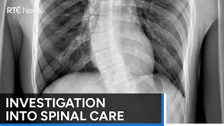 Scoping report recommends commission of investigation into child spinal care | RTÉ News