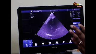91 CHILDREN SCREENED