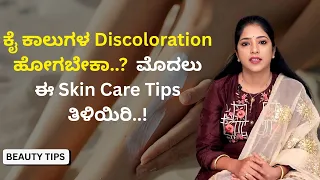 ಕೈ ಕಾಲುಗಳ Discoloration ಹೋಗಬೇಕಾ..?  ಮೊದಲು ಈ Skin Care Tips ತಿಳಿಯಿರಿ..!  | Beauty Tips | Ayush TV