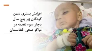 افزایش بستری شدن کودکان زیر پنج سال دچار سوء تغذیه در مراکز صحی افغانستان