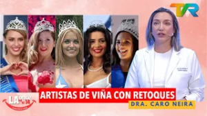 ARTISTAS DE VIÑA CON RETOQUES CON LA DRA. CARO NEIRA | LA ONCE EN EL 14