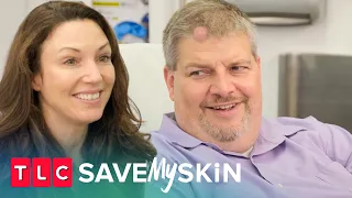 Stumped by Lumps and Bumps | Save My Skin | TLC
