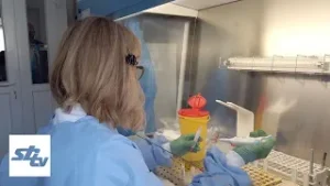 SBTV - DNEVNIK - MEĐUNARODNI DAN BORBE PROTIV RAKA - 04.02.2026.