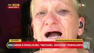 Atacaron a la familia del “Michael Jackson paraguayo”