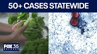 Florida Cyclosporiasis cases top 460 after surge