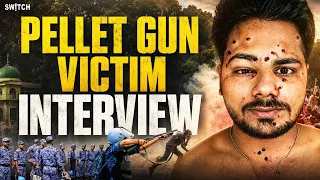 Why Were Pellet Guns Used During the Parliament March? Victim Shares His Story