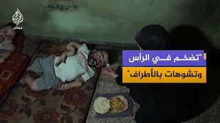 "Urgent message".. A Palestinian appeals to the world