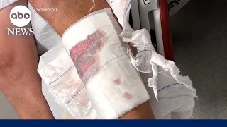 Connecticut man speaks out after shark attack in the Bahamas