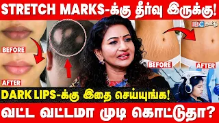 சருமத்தில் Stretch Marks வரக் காரணம் என்ன? Carolin Praba Reddy | Founder & MD V Care | IBC Tamil