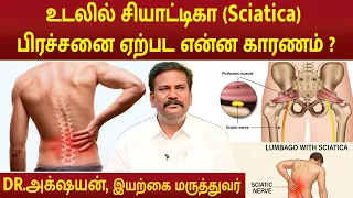 உடலில் சியாட்டிகா (Sciatica) பிரச்சனை ஏற்பட என்ன காரணம் ? | Dr.Akshayan |