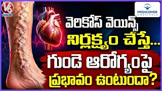 Good Health :  If Varicose Veins Are Neglected.. Does It Affect Heart..? | Medicover Hospitals | V6