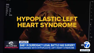Baby at center of LA-Texas surrogacy legal battle undergoes heart surgery, attorney says