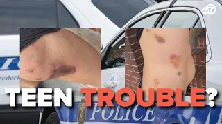 ‘They bludgeoned me’: Man describes alleged teen attack in Maryland