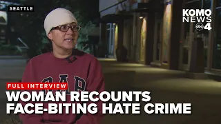 Full Interview: Seattle woman recounts having part of face bitten off by suspect in downtown