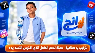 لتركيب يد صناعية.. حملة لدعم الطفل الذي افترس الأسد يده | رائج