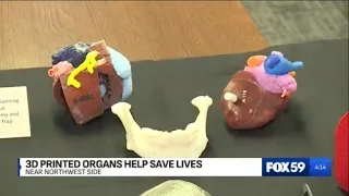 3D printed organs help save lives