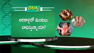 అరికాళ్లలో మంటలు బాధిస్తున్నాయా?| Are You Troubled by a Burning Sensation in Your Soles? |Sukhibhava