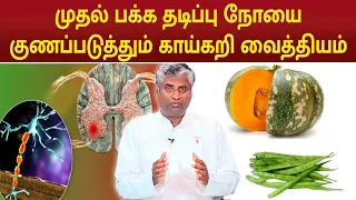 முதல் பக்க தடிப்பு நோயை குணப்படுத்தும் காய்கறி வைத்தியம் Primary lateral Sclerosis|B.K.Arun Prakash
